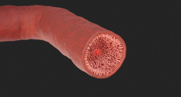 Colon Cancer Rate by Country