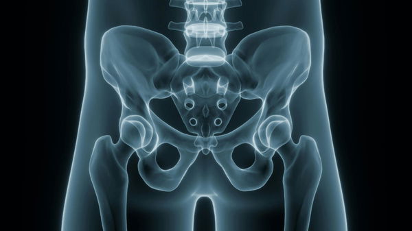 Hip Replacement Cost by Country