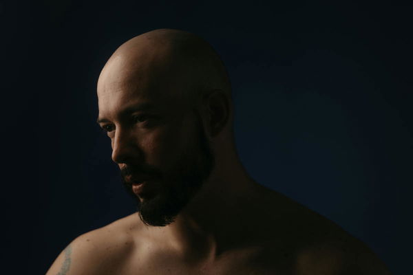 Percentage of Bald Males by Country