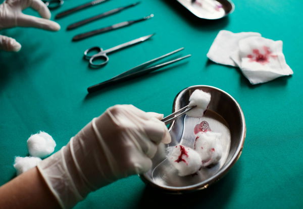 Autopsy Laws by State